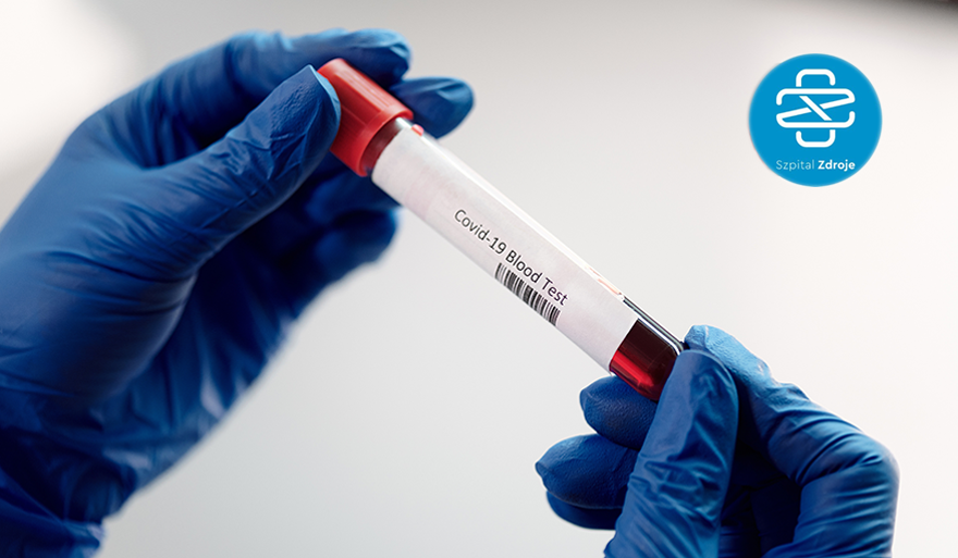 Bezpłatne badania na obecność przeciwciał w kierunku SARS-CoV-2